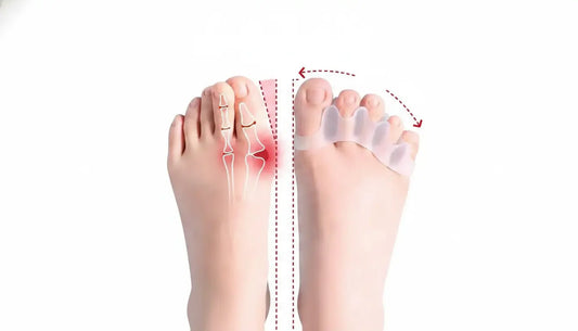 When Your Toes Are the Last Thing You Think About — Until They're Not