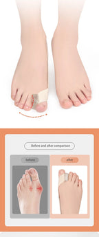 Toe Corrector Strap Separator Splint