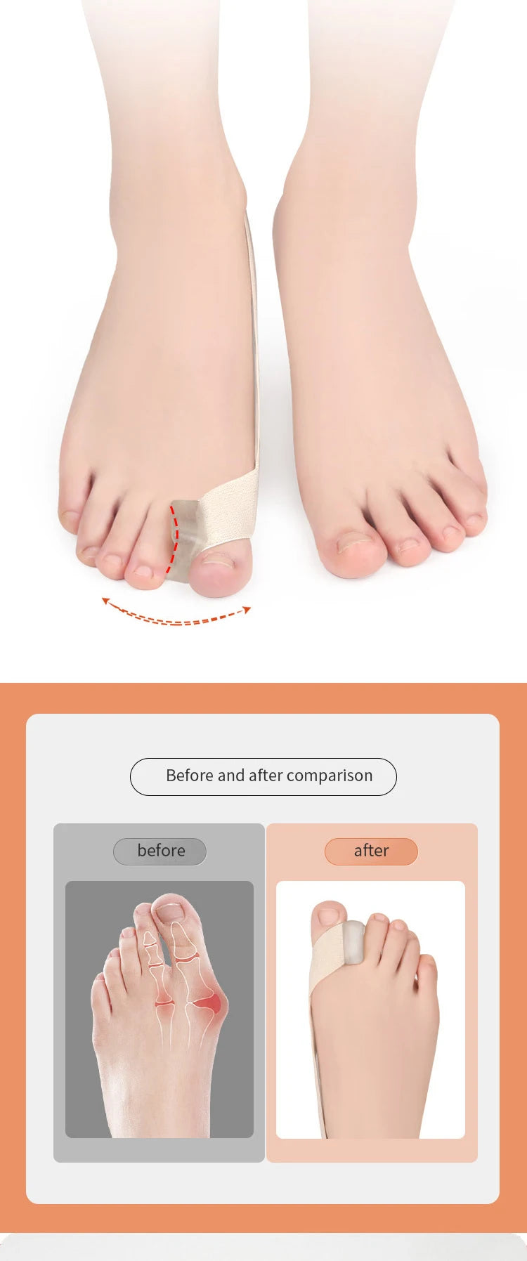 Hallux Valgus Toe Corrector Strap Toe Separator Splint S/L