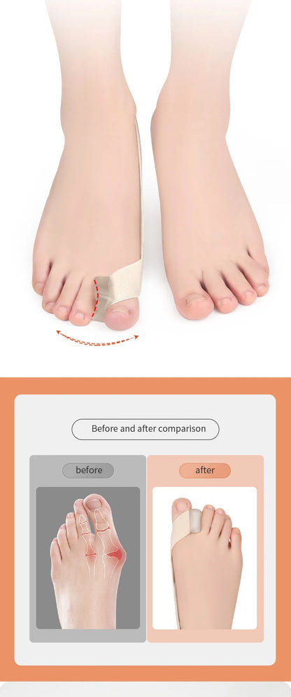 Hallux Valgus Toe Corrector Strap Toe Separator Splint S/L