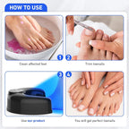 Blue Light Anti Fungal Laser