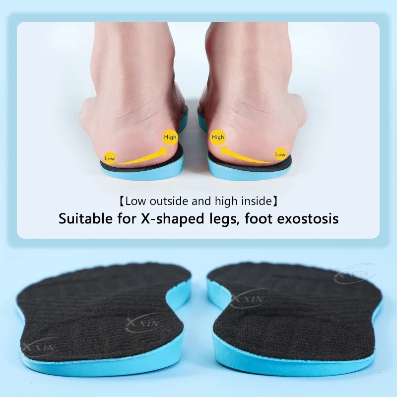Orthopedic Correction Insoles