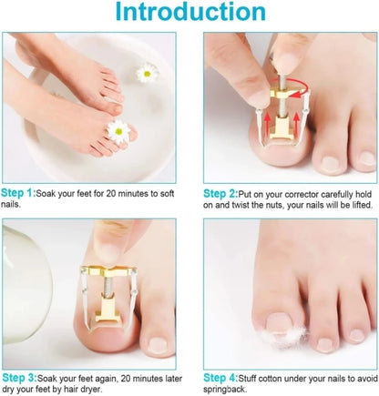Toenail Correction Bracket