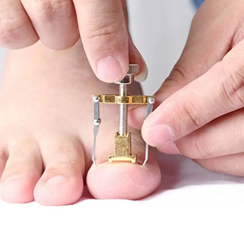 Toenail Correction Bracket