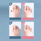 Silicone Toe Separator