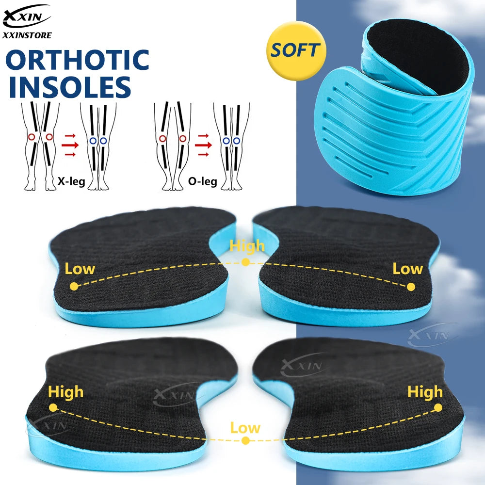 Orthopedic Correction Insoles for X Leg O Leg Arch Support – HWY PT ...