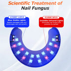 Blue Light Anti Fungal Laser