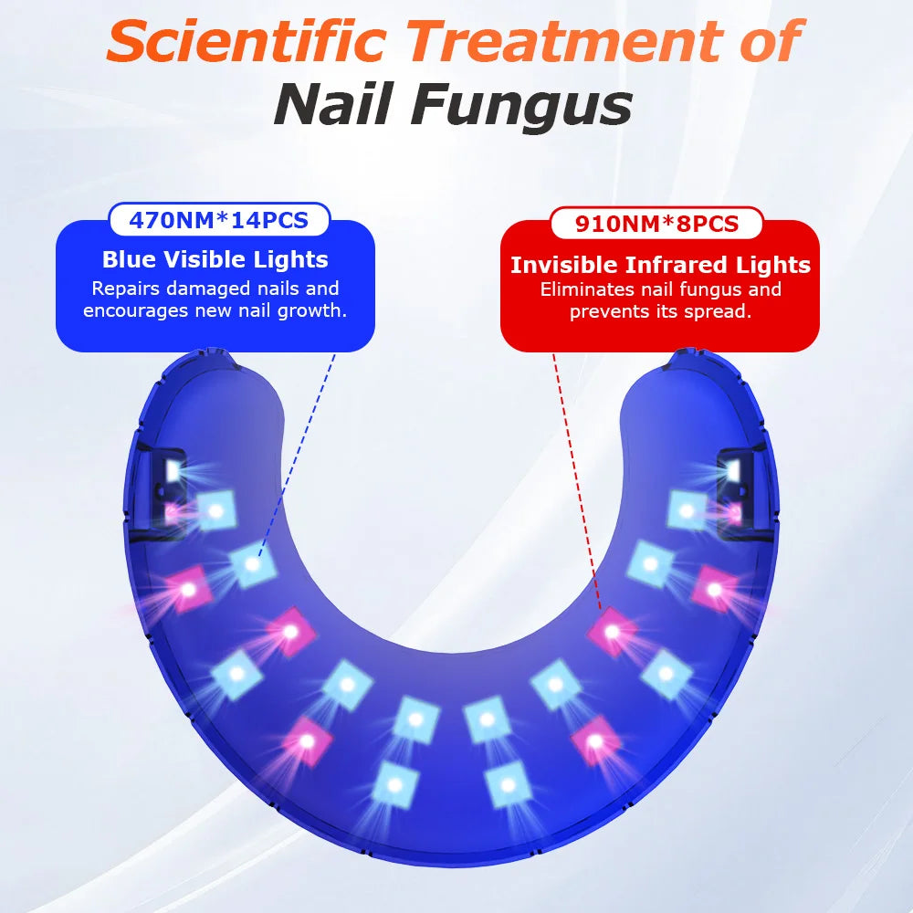 Blue Light Anti Fungal Laser
