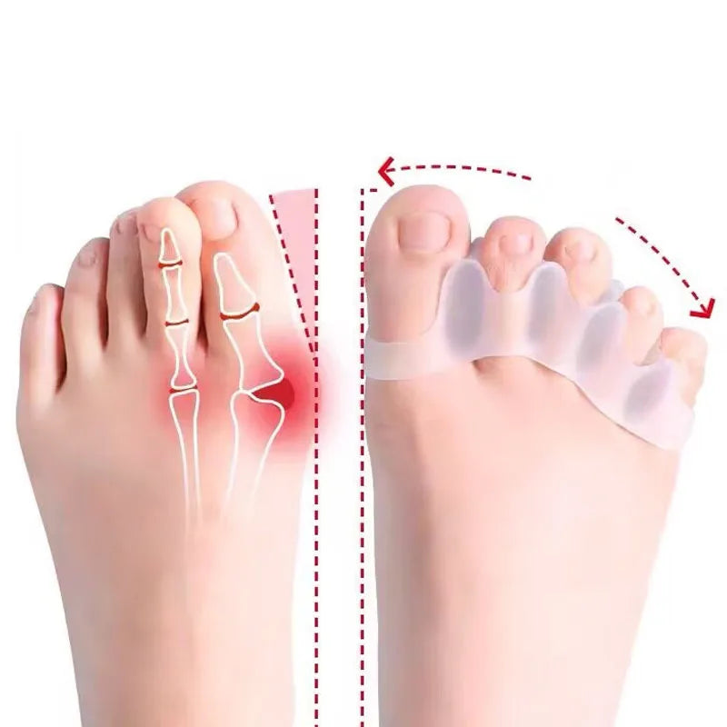 Silicone Toe Separator