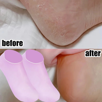 Silicone Moisturizing Foot Socks